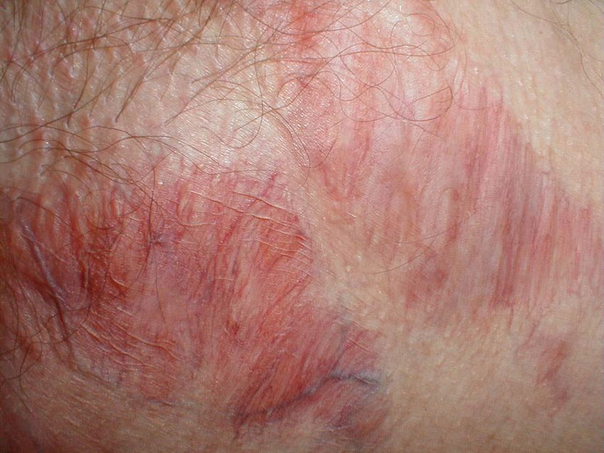 Tackling Topical Pharmacotherapeutics A Casebased and Practical