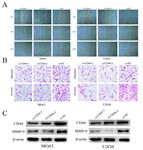 Downregulation of CD44 Inhibits Proliferation, Invasion and Migration of Osteosarcoma Cells by Regulating the Expression of Cathepsin S