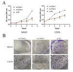 Downregulation of CD44 Inhibits Proliferation, Invasion and Migration of Osteosarcoma Cells by Regulating the Expression of Cathepsin S