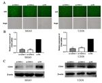 Downregulation of CD44 Inhibits Proliferation, Invasion and Migration of Osteosarcoma Cells by Regulating the Expression of Cathepsin S