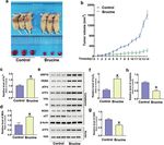 ATF3 contributes to brucine-triggered glioma cell ferroptosis via promotion of hydrogen peroxide and iron
