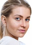 Innovative non-invasive mesotherapy solutions - mesoskinline ...
