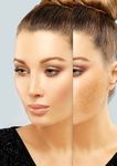 Innovative non-invasive mesotherapy solutions - mesoskinline ...
