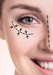 Innovative non-invasive mesotherapy solutions - mesoskinline ...