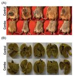 Can NBTXR3 turn anti-PD-1 non responders into responders and deepen anti-PD-1 response in naïve patients? - Nanobiotix
