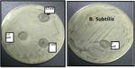 Plasma-liquid synthesis of silver nanoparticles and their antibacterial and antifungal applications - IOPscience
