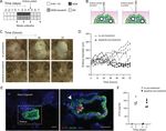 Modelling the impact of decidual senescence on embryo implantation in human endometrial assembloids