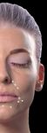 Dermal Fillers for Dental Professionals - Quintessence ...