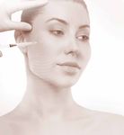Dermal Fillers for Dental Professionals - Quintessence ...