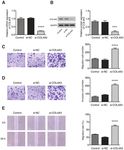 Differential expression of COL4A3 and collagen in upward and downward progressing types of nasopharyngeal carcinoma