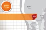 Take your life back from cancer - Life advances - New York Proton Center