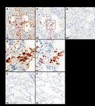SENSITIVE AND SPECIC IMMUNOHISTOCHEMISTRY PROTOCOLS FOR DETECTION OF SARS-COV-2 NUCLEOCAPSID AND SPIKE PROTEINS IN FORMALIN-XED, PARAN...