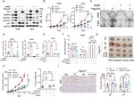 E47 upregulates &Delta;Np63&alpha; to promote growth of squamous cell carcinoma