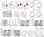 E47 upregulates &Delta;Np63&alpha; to promote growth of squamous cell carcinoma