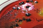 Salmonella from Farm to Table: Isolation, Characterization, and Antimicrobial Resistance of Salmonella from Commercial Broiler Supply Chain and ...