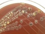 Salmonella from Farm to Table: Isolation, Characterization, and Antimicrobial Resistance of Salmonella from Commercial Broiler Supply Chain and ...