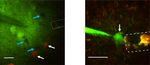 Non-genetic photoacoustic stimulation of single neurons by a tapered fiber optoacoustic emitter