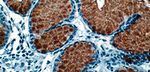 IHC PANEL MARKERS Pancreas Cancer Panel - BioGenex