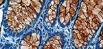 IHC PANEL MARKERS Pancreas Cancer Panel - BioGenex