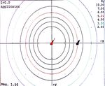 High-dose rate brachytherapy for palliative care in rectal cancer: A case with a complete response, followed by a rare complication