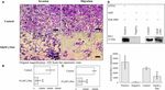 The Atypical Protein Kinase C Small Molecule Inhibitor &zeta;-Stat, and Its Effects on Invasion Through Decreases in PKC-&zeta; Protein Expression - Frontiers