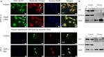 The Atypical Protein Kinase C Small Molecule Inhibitor &zeta;-Stat, and Its Effects on Invasion Through Decreases in PKC-&zeta; Protein Expression - Frontiers