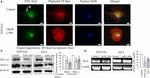The Atypical Protein Kinase C Small Molecule Inhibitor &zeta;-Stat, and Its Effects on Invasion Through Decreases in PKC-&zeta; Protein Expression - Frontiers
