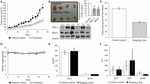 The Atypical Protein Kinase C Small Molecule Inhibitor &zeta;-Stat, and Its Effects on Invasion Through Decreases in PKC-&zeta; Protein Expression - Frontiers