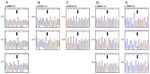 Novel Polymorphisms and Genetic Characteristics of the Prion Protein Gene (PRNP) in Dogs-A Resistant Animal of Prion Disease - MDPI