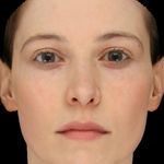 A Parametric Freckle Model for Faces - gravis