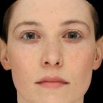 A Parametric Freckle Model for Faces - gravis