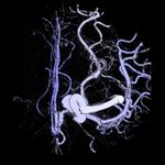 A Bounded Measure for Estimating the Benefit of Visualization: Case Studies and Empirical Evaluation - arXiv