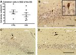 Notch3-Dependent Effects on Adult Neurogenesis and Hippocampus-Dependent Learning in a Modified Transgenic Model of - CADASIL