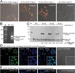 Expression of RUNX1-JAK2 in Human Induced Pluripotent Stem Cell-Derived Hematopoietic Cells Activates the JAK-STAT and MYC Pathways