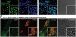 Expression of RUNX1-JAK2 in Human Induced Pluripotent Stem Cell-Derived Hematopoietic Cells Activates the JAK-STAT and MYC Pathways