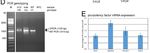 Expression of RUNX1-JAK2 in Human Induced Pluripotent Stem Cell-Derived Hematopoietic Cells Activates the JAK-STAT and MYC Pathways