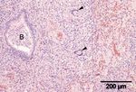 Generalized sarcoidosis in two horses - ild care foundation