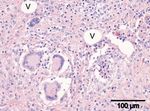 Generalized sarcoidosis in two horses - ild care foundation