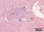 Generalized sarcoidosis in two horses - ild care foundation
