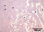 Generalized sarcoidosis in two horses - ild care foundation