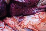Generalized sarcoidosis in two horses - ild care foundation