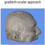 EEG representing on brain surface using volume rendering