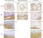 TCYSL3, A MEMBER OF THE YSL GENE FAMILY FROM THE HYPER-ACCUMULATOR THLASPI CAERULESCENS, ENCODES A NICOTIANAMINE- NI/FE TRANSPORTER