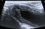Ultrasonographic Diagnosis of Urachal Anomalies in Cats and Dogs: Retrospective Study of 98 Cases (2009-2019)