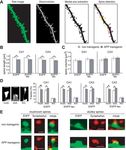 Divergent Pathways Mediate Spine Alterations and Cell Death Induced by Amyloid- , Wild-Type Tau, and R406W Tau
