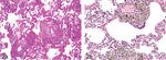Incidences and Range of Spontaneous Findings in Control Cynomolgus Monkeys (Macaca fascicularis) Used in Toxicity Studies