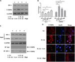 Xanthohumol Attenuated Inflammation and ECM Degradation by Mediating HO-1/C/EBP&beta; Pathway in Osteoarthritis Chondrocytes - Frontiers