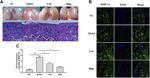 Xanthohumol Attenuated Inflammation and ECM Degradation by Mediating HO-1/C/EBP&beta; Pathway in Osteoarthritis Chondrocytes - Frontiers