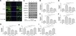Xanthohumol Attenuated Inflammation and ECM Degradation by Mediating HO-1/C/EBP&beta; Pathway in Osteoarthritis Chondrocytes - Frontiers