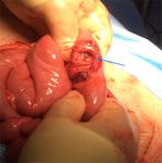 Horse Kick to the Abdomen Causing a Triad of Injury: A Case Report - Cureus